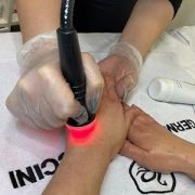 Aparatología con la que está realizando un tratamiento en unas manos.